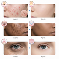 Masque LED Visage NOVEA — Routine beauty tech 7 couleurs